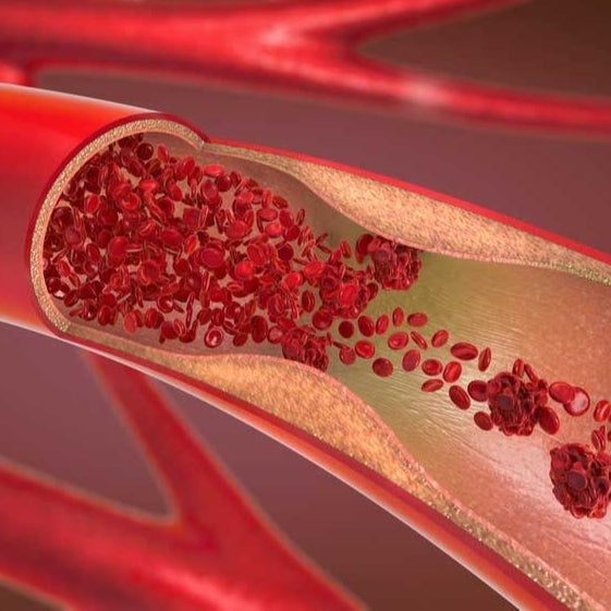 Warning Signs of Blood Clots During Sleep: Don't Ignore These Symptoms