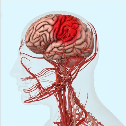 Stroke is More Likely to Occur at Night: Warning Signs Before Bedtime