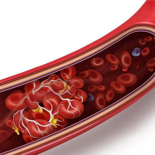 Preventing Thrombosis Starts with Eating the Right 7 Types of Foods